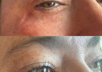 Prestation cils